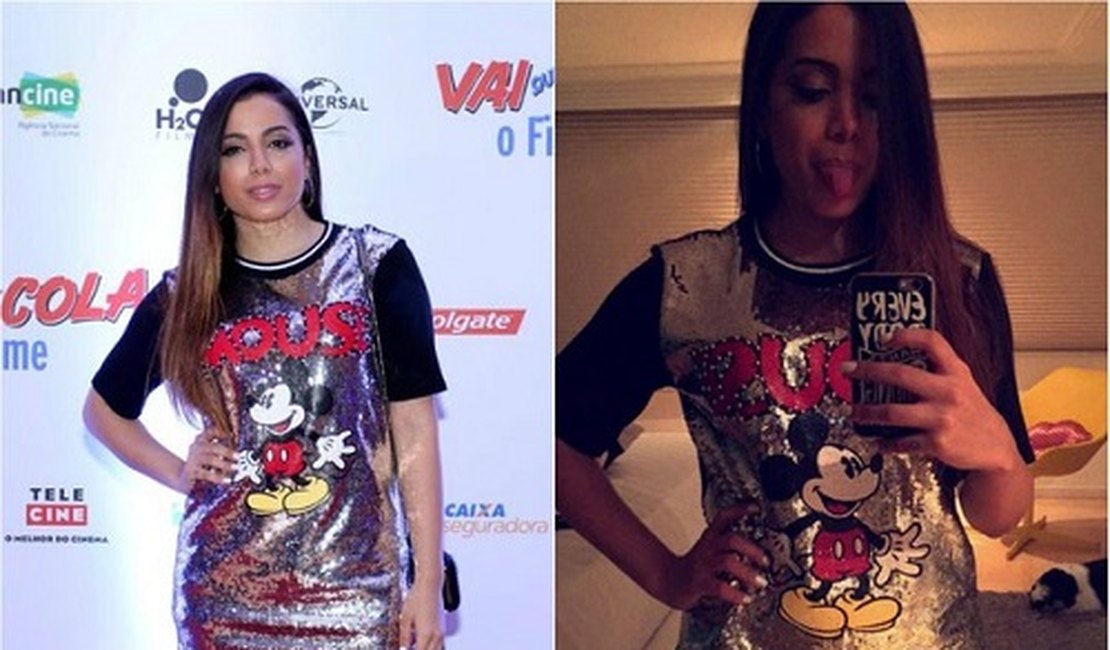 Anitta reclama da aparência em fotos de sites: 'Parece que engoli um ovo'