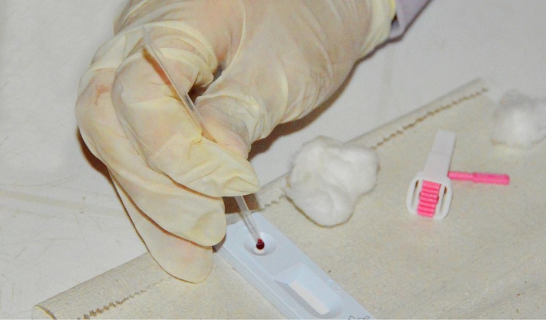 Sesau abre inscrições para o Curso sobre as Diretrizes de Diagnóstico do HIV, Hepatites e Sífilis