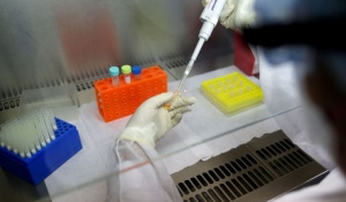Anvisa permite teste clínico para tratar pneumonia causada por Covid; saiba mais
