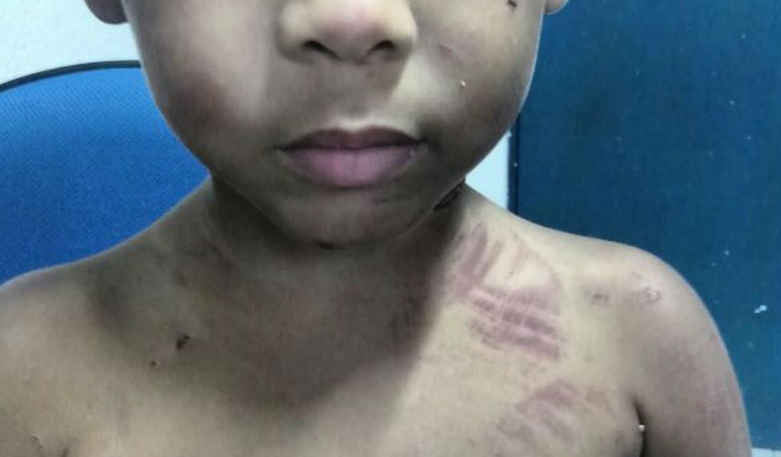 Pai é denunciado por torturar filho de três anos dentro de casa no Vergel, em Maceió