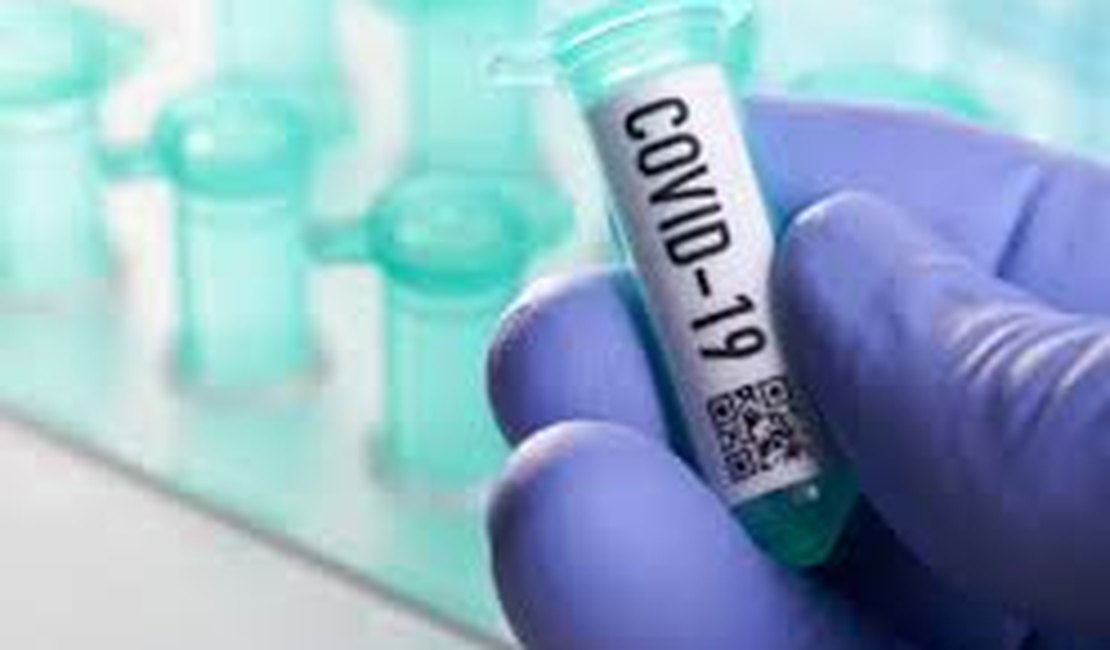 Covid-19: Arapiraca registra mais de 5 mil casos confirmados e 119 mortes
