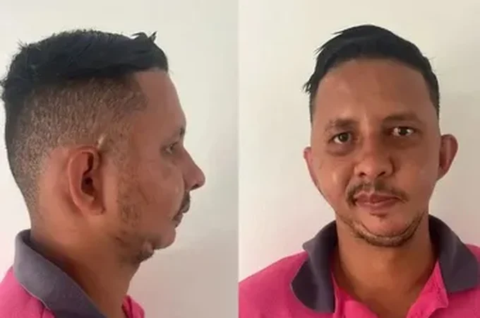 Homem alvo de piada de Carlinhos Maia espera há mais de 10 anos por cirurgia de R$ 471 mil
