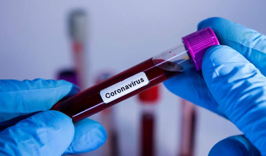 Covid-19: Arapiraca registra 7.735 confirmados e mais 4 óbitos