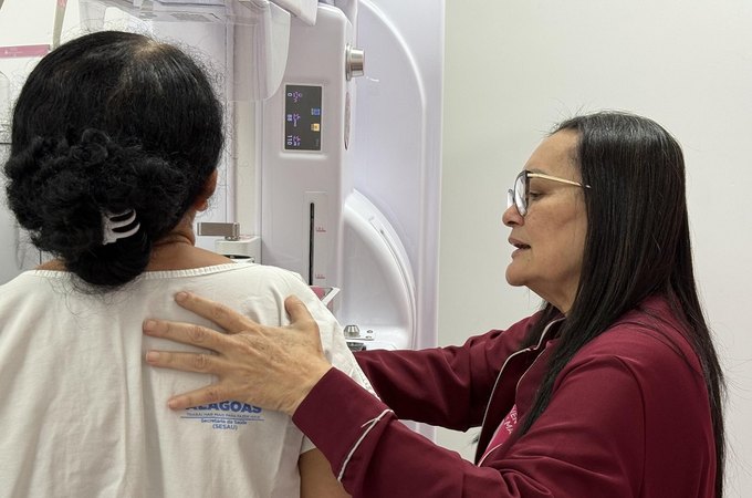 Governo de Alagoas oferta exame gratuito de mamografia para servidoras do Estado