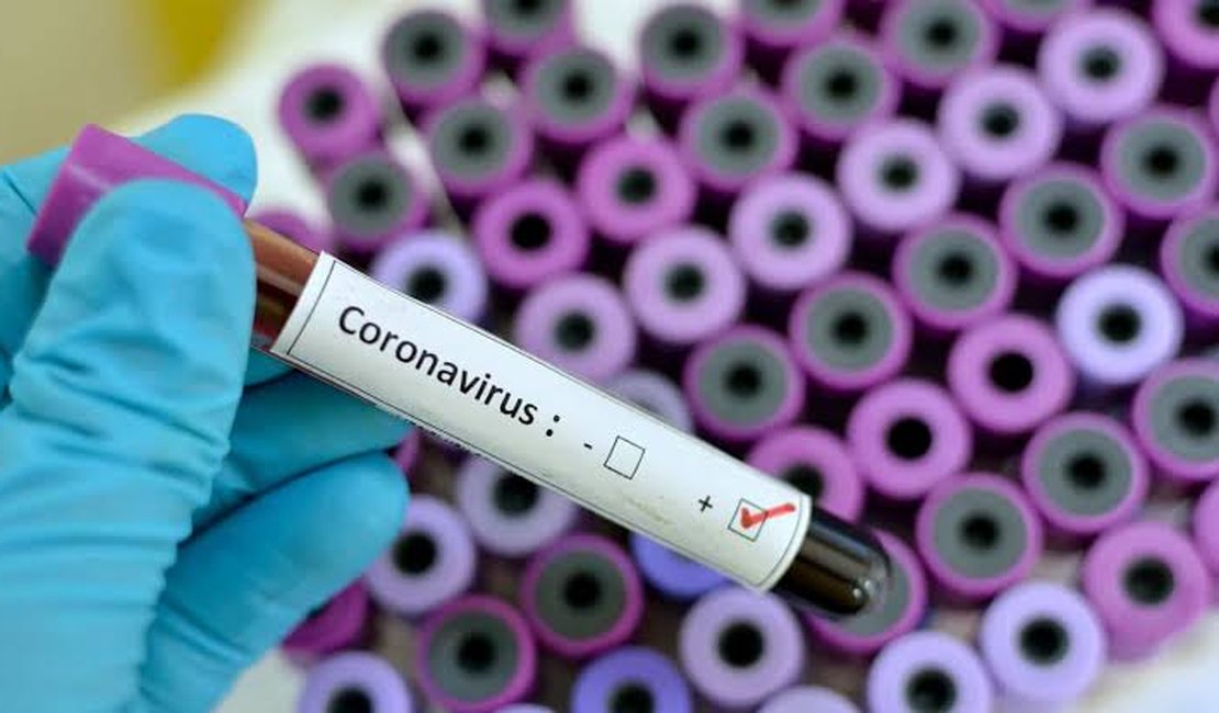 Covid-19: Alagoas registra mais oito mortes e 247 novos casos de Covid-19 nas últimas 24h