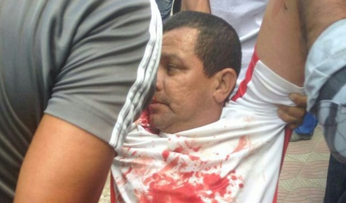 Policial Militar é baleado durante tentativa de assalto em União dos Palmares
