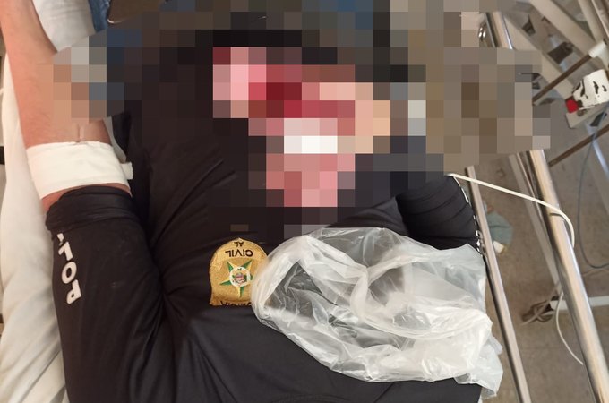 Filho de fazendeiro alagoano que teria encomendado e comemorado a morte do pai reage à prisão e atira em policial civil