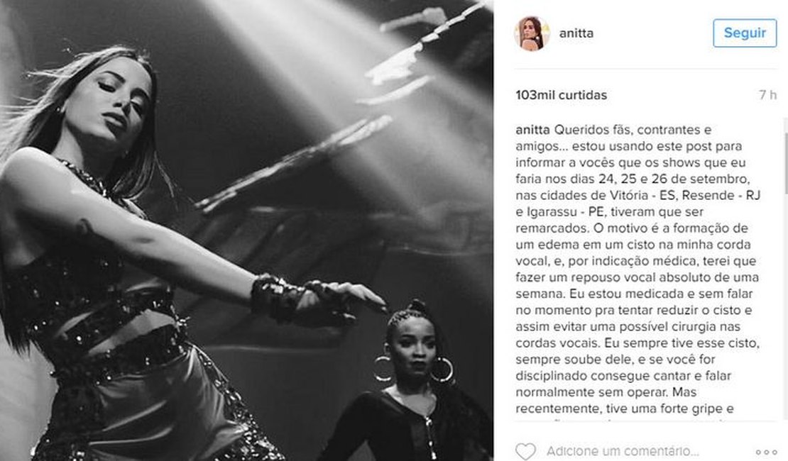 Anitta cancela shows devido a edema e cisto nas cordas vocais