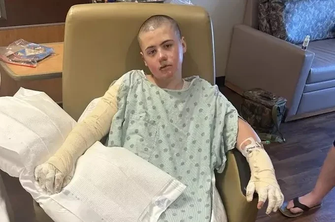 Menino de 12 anos fica internado após se queimar fazendo trend das redes sociais