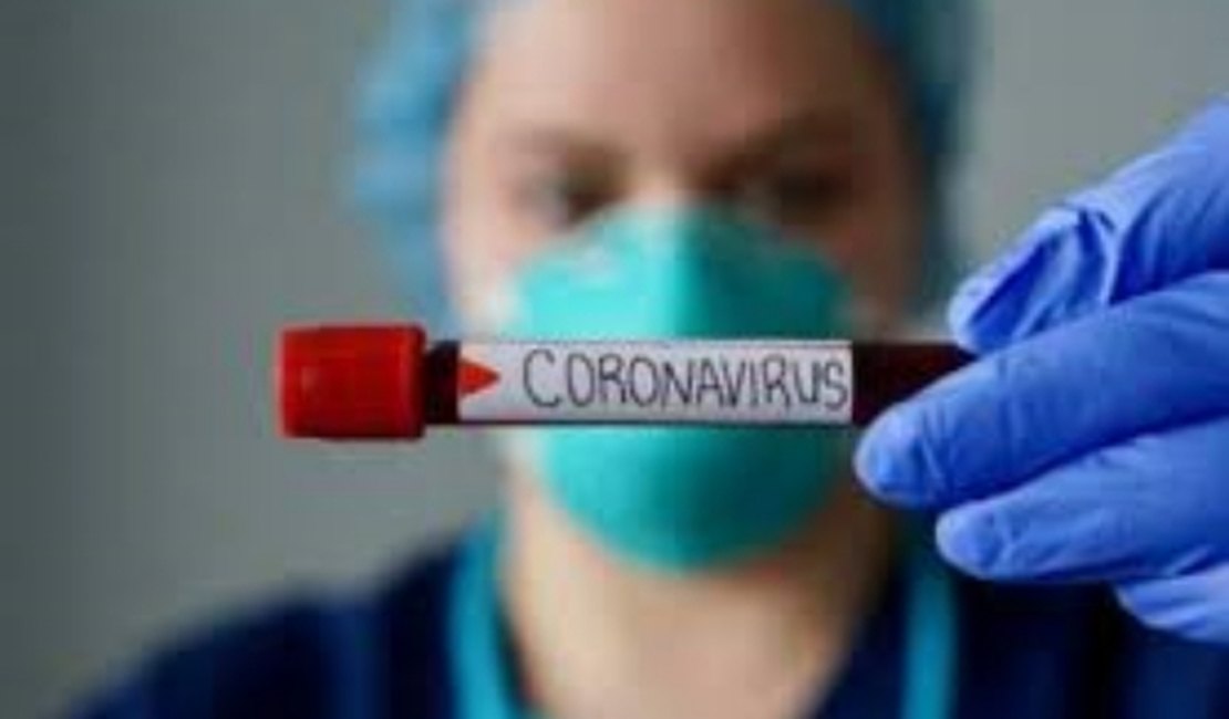 Cientistas investigam motivo de homens serem as maiores vítimas da covid-19