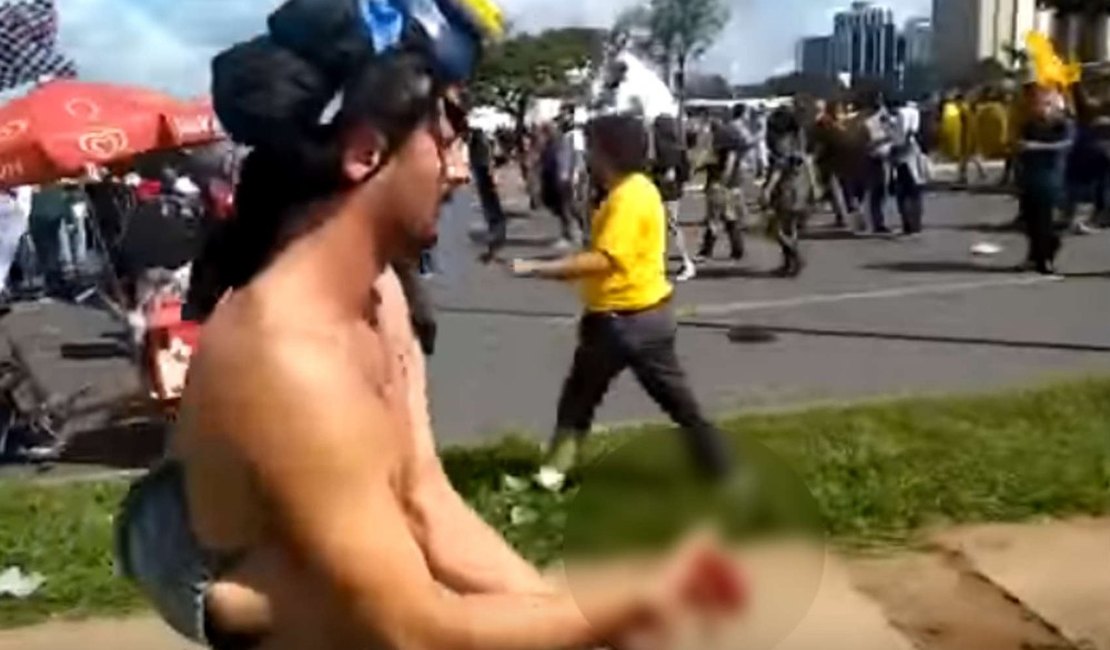 Jovem tem mão dilacerada em ato na Esplanada; protesto teve 49 feridos