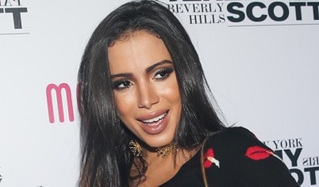 Arrependida? Anitta tenta reversão de procedimento estético nos lábios