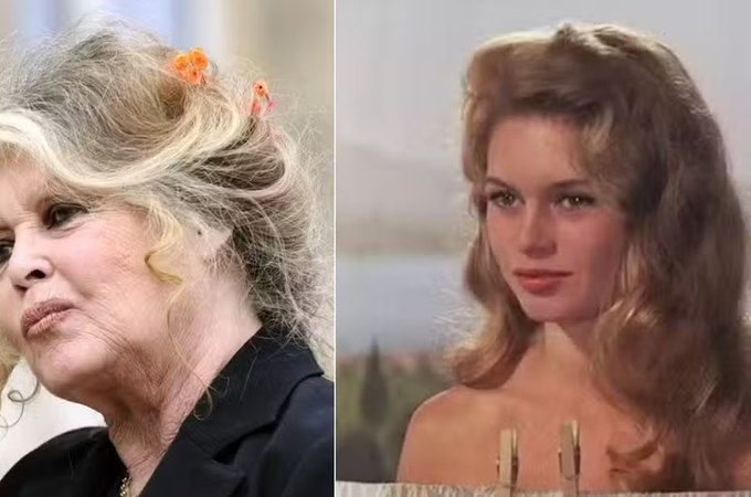 Brigitte Bardot, de 91 anos, é internada em estado grave e passa por cirurgia na França