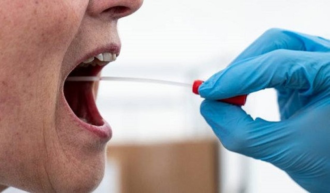 Com 90% de eficácia, SWAB será disponibilizado em Arapiraca para testagem de Covid-19