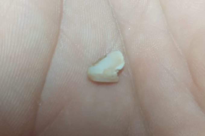 Cliente encontra dente em fatia de pizza comprada em estabelecimento de Arapiraca