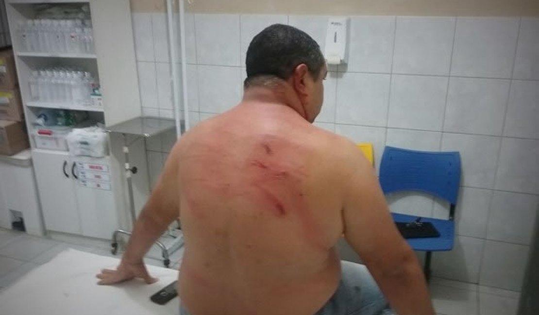 Radialista alagoano é agredido no Agreste de Pernambuco