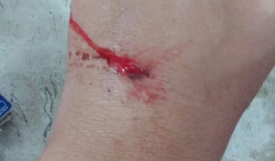 Mulher é atacada por rottweiler dentro de Petshop, em Arapiraca
