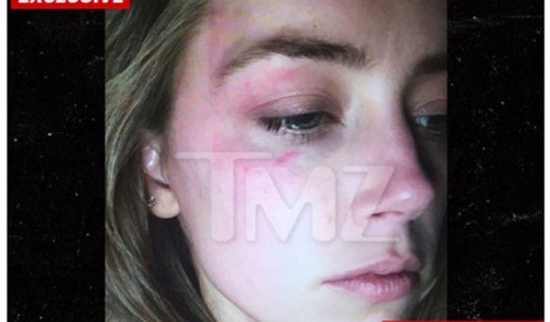 Esposa de Johnny Depp pede divórcio após agressão, diz site
