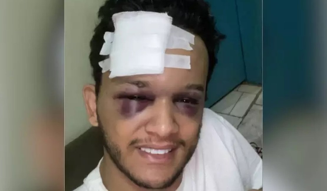 Cantor sertanejo sofre acidente em rodovia no MS e tem traumatismo craniano