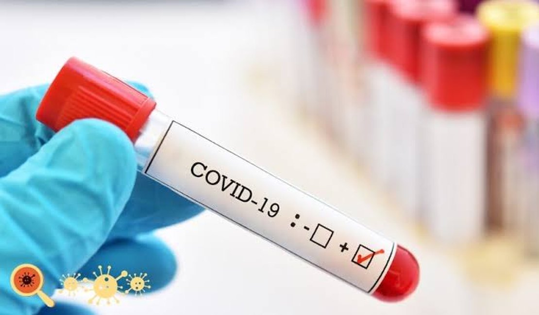 Arapiraca inicia o mês de agosto com mais de 5 mil recuperados de covid-19