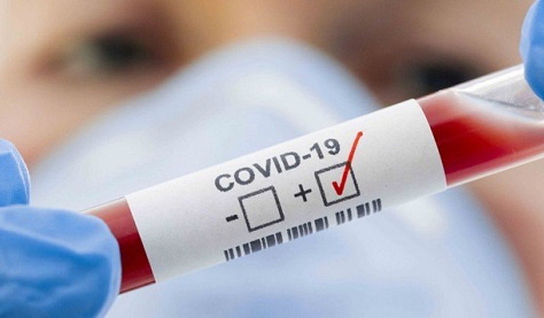 Covid-19: 3.513 alagoanos ainda estão em isolamento domiciliar