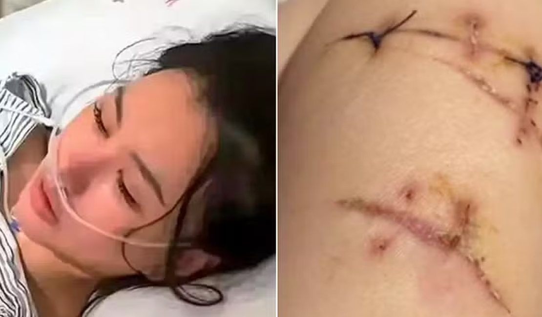 Mulher golpeada com faca 22 vezes é salva por próteses de silicone