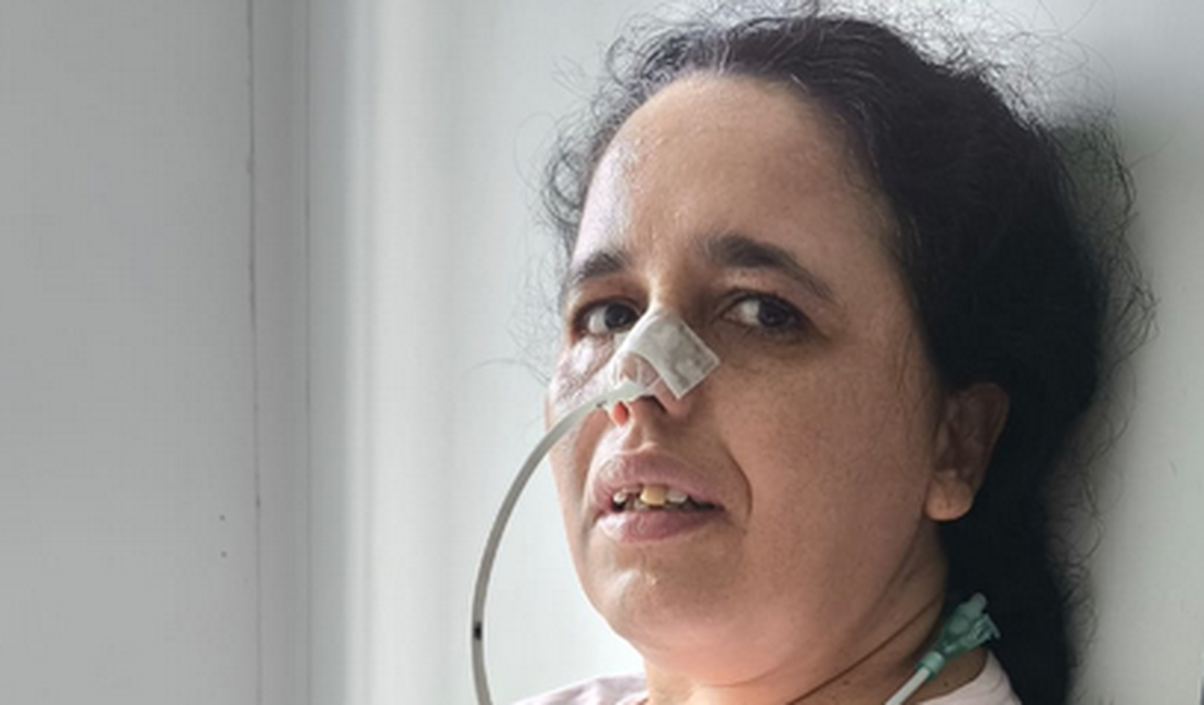 Com doença rara e degenarativa, mulher natural de Palmeira dos Índios precisa de ajuda para realizar cirurgia de urgência