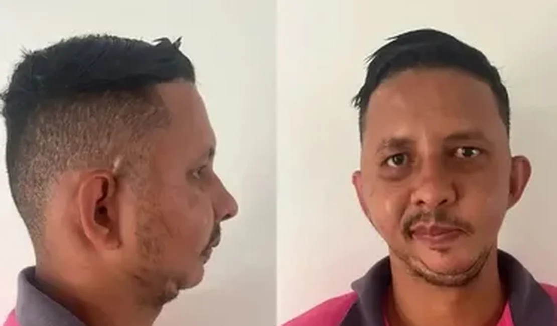 Homem alvo de piada de Carlinhos Maia espera há mais de 10 anos por cirurgia de R$ 471 mil