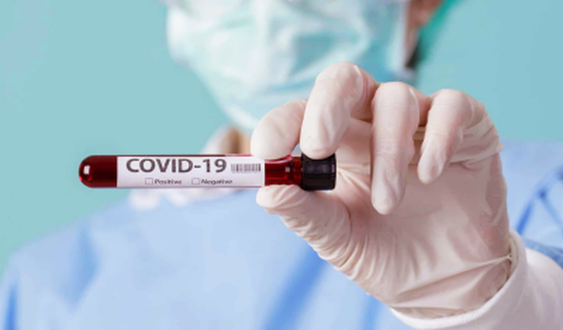 Covid-19: Planos de Saúde são liberados da obrigação de pagar testes sorológico