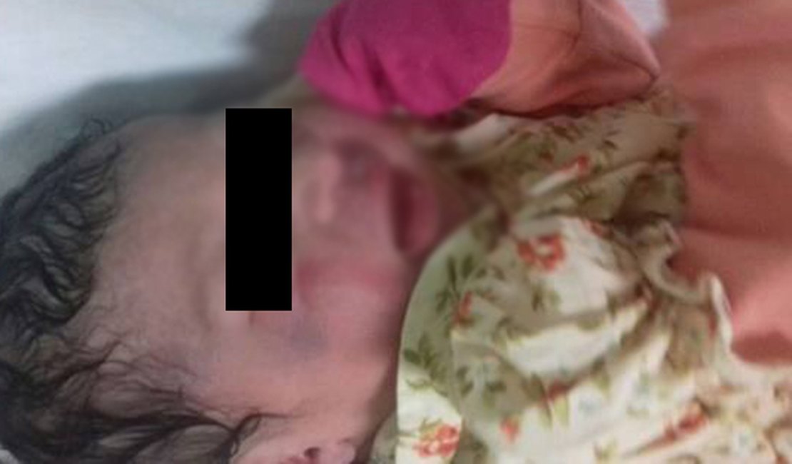 Bebê nasce com manchas roxas na cabeça e família questiona procedimento de parto