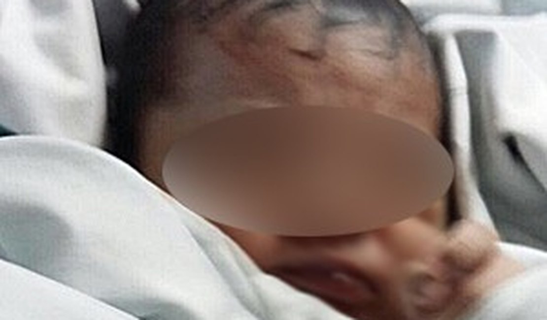 Bebê é encontrado em lixeira de hospital em Pernambuco