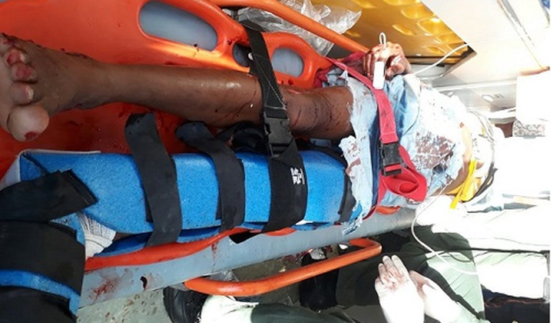 Adolescente tem braço amputado em colisão entre carro e moto no interior