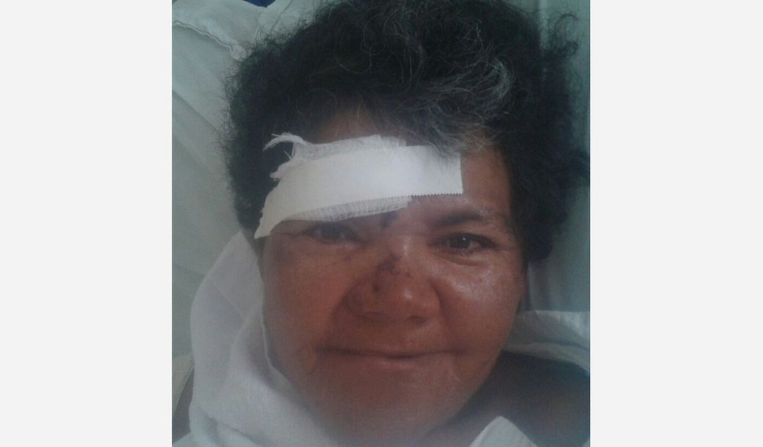Hospital de PE pede ajuda para localizar família de alagoana atropelada