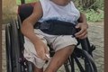 Morre, aos 15 anos, menino que sofria com 'ossos de vidro' em Feira de Santana