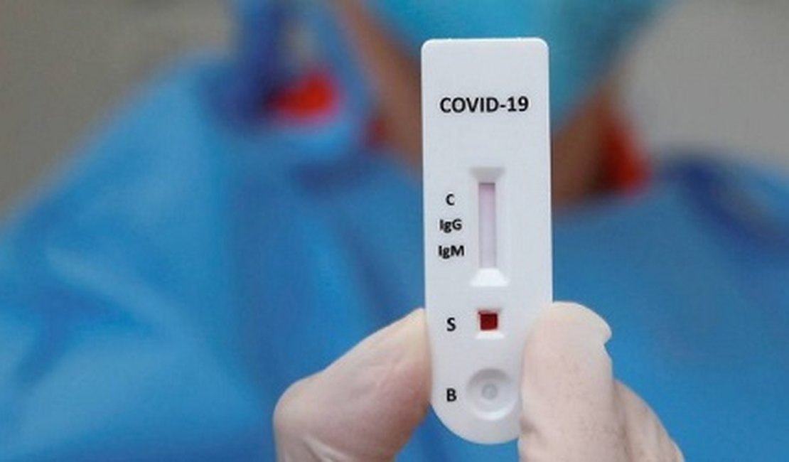 Resolução da ANS obriga planos de saúde a realizar teste sorológico para Covid-19