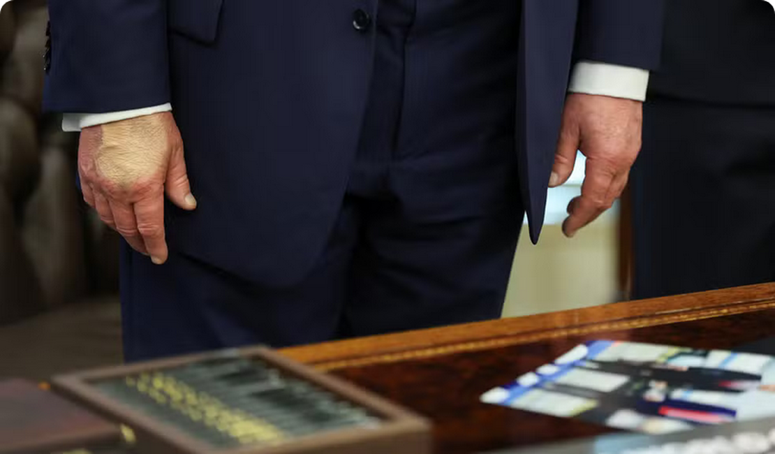 Trump volta a aparecer em público usando maquiagem na mão, um mês depois de diagnóstico de insuficiência venosa crônica