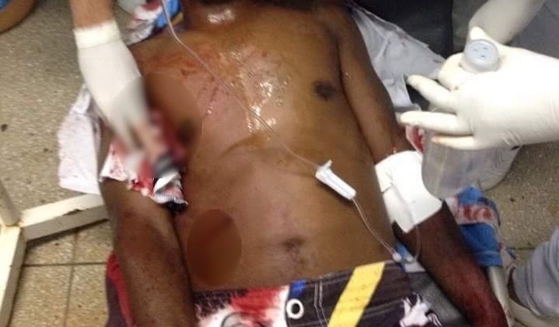 Homem fica gravemente ferido após ser baleado em Teotônio Vilela