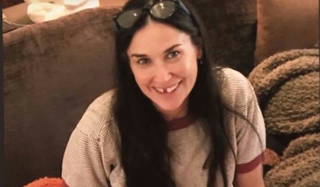 Demi Moore perde os dentes da frente por estresse; veja