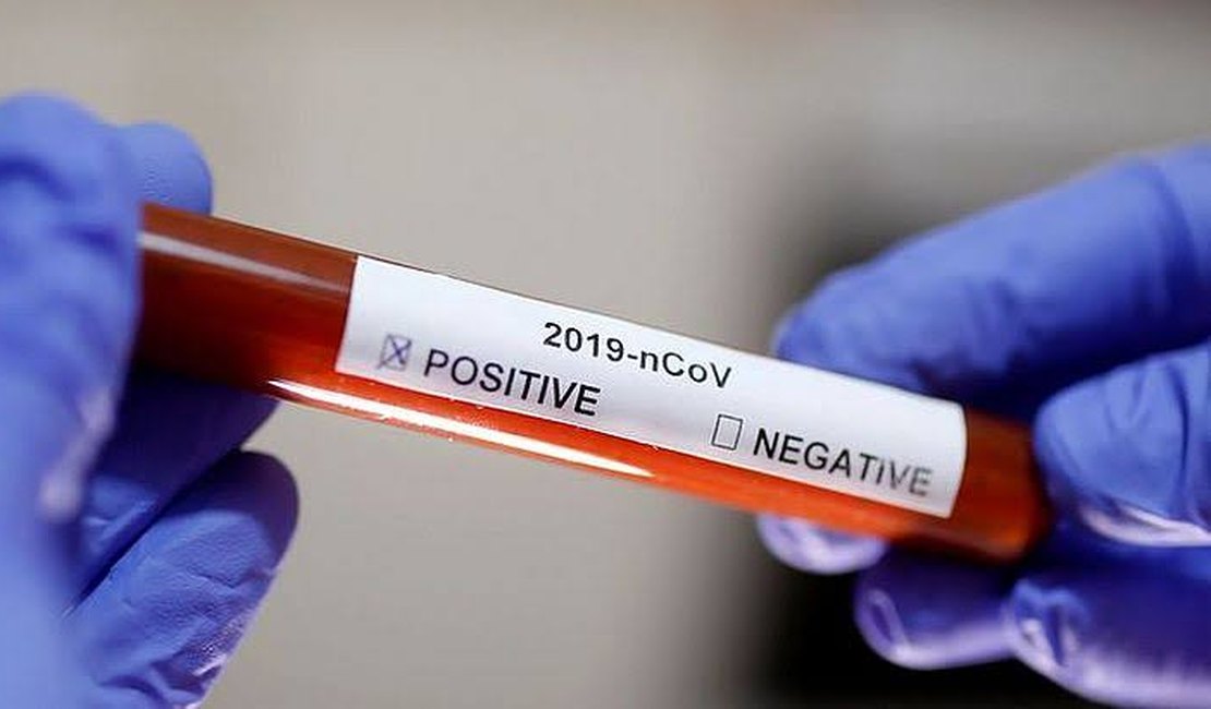 Covid-19: Alagoas registra 309 novos casos e tem 115 pessoas internadas