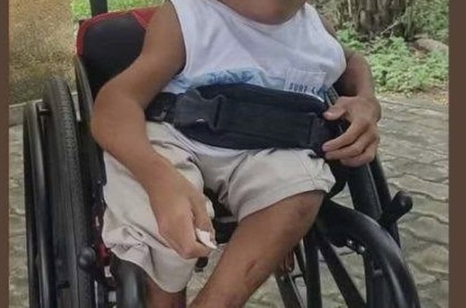 Morre, aos 15 anos, menino que sofria com 'ossos de vidro' em Feira de Santana
