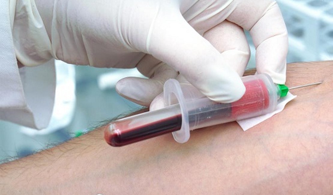 Pesquisadores desenvolvem exame de sangue que pode diagnosticar esquizofrenia