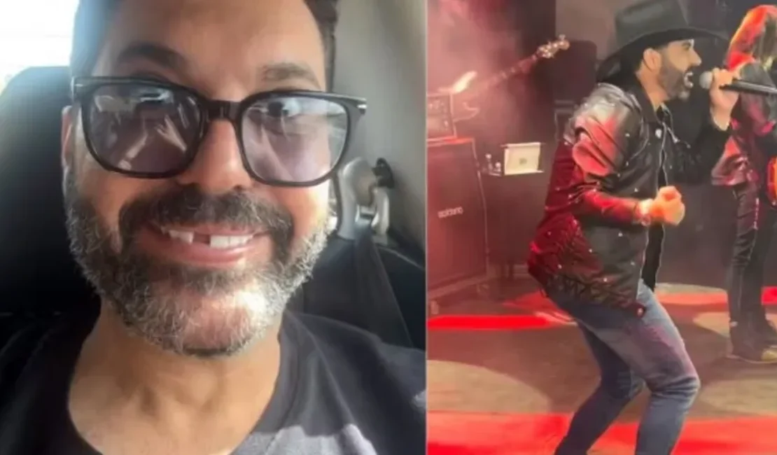 Cantor Edson, da dupla com Hudson, perde dente ao roer osso de frango antes de show