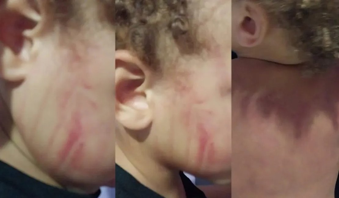 Vizinhos de mulher que espancou bebê dizem que ela costumava agredir os filhos