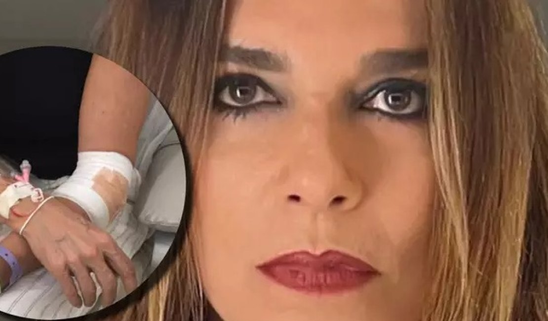 Atriz Mara Carvalho é atropelada por manobrista do carro dela na saída de restaurante