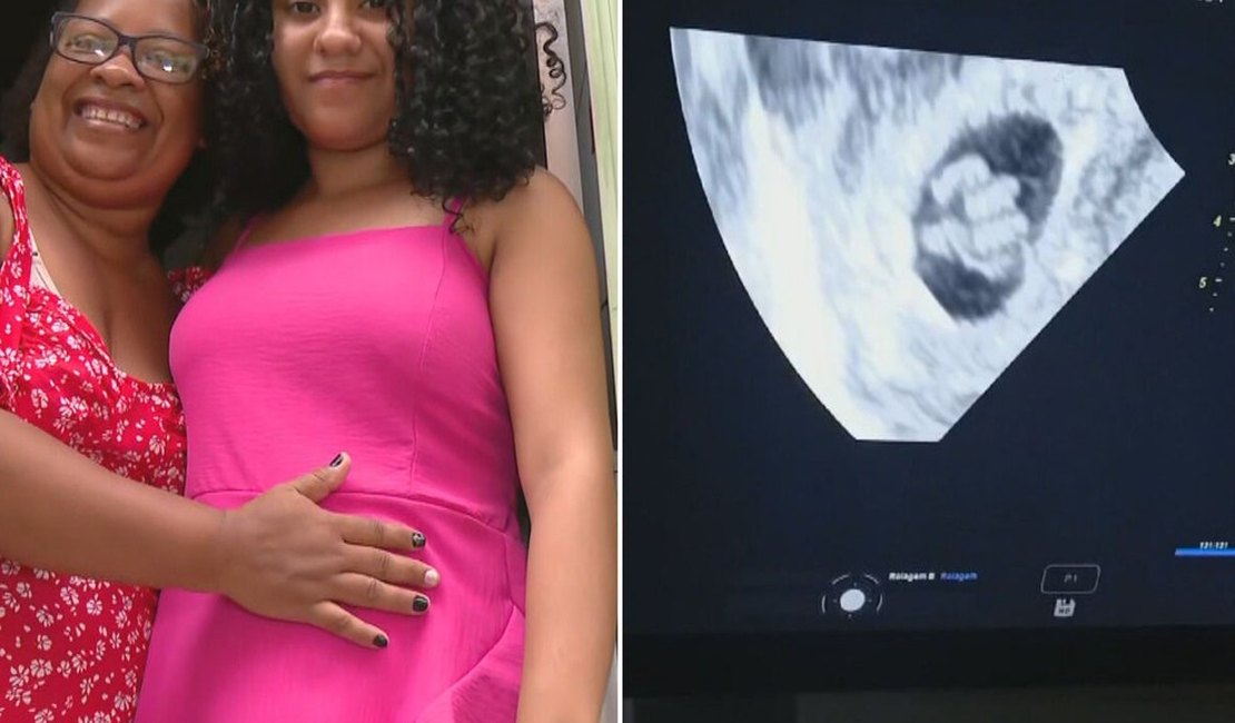 Jovem descobre que está grávida de quíntuplos e chega a passar mal durante ultrassom
