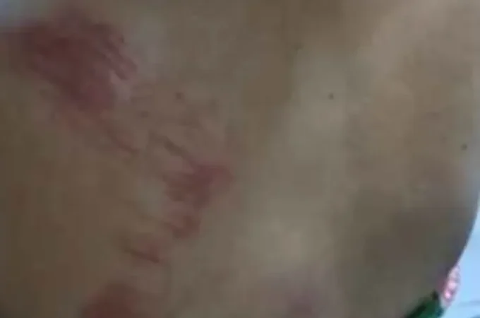 Com ciúmes, homem dá soco em companheira e tenta matá-la estrangulada em Piaçabuçu
