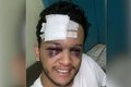 Cantor sertanejo sofre acidente em rodovia no MS e tem traumatismo craniano