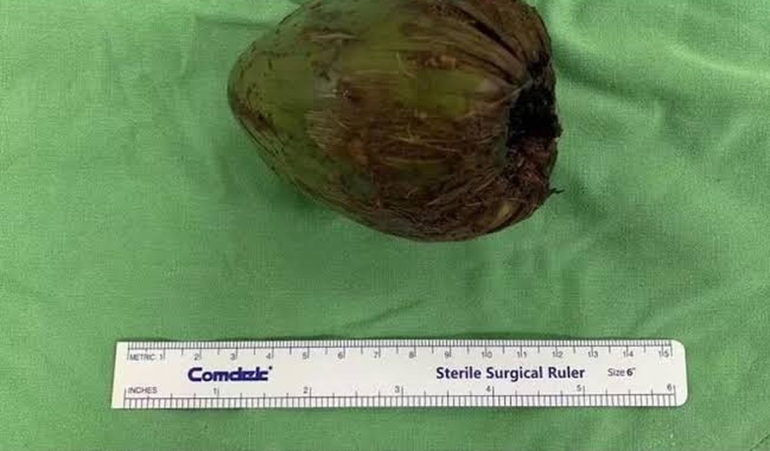 Homem é socorrido para o hospital após introduzir um coco no ânus