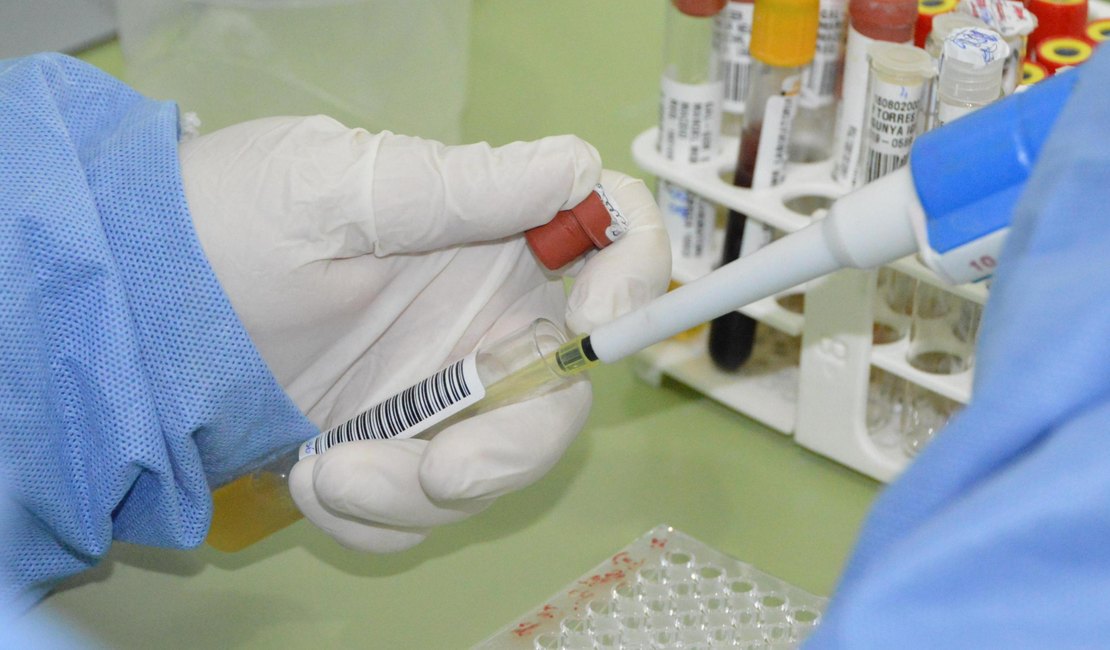 Com 7 casos este ano em Alagoas, Sesau reforça medidas de prevenção contra meningite