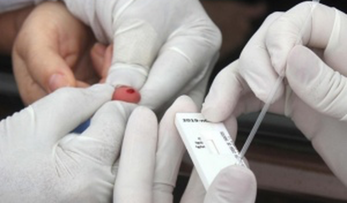 Alagoas se aproxima dos 20 mil casos confirmados de Covid-19 e registra 681 óbitos